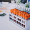 40歳から始まる特定健診とは？メタボリックシンドローム予防の視点から