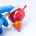 認知症予防のためのバランスの取れた食生活の工夫とおすすめレシピ